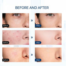 Load image into Gallery viewer, Large Deluxe HD Laser Light Facial Treatment Therapy Pod